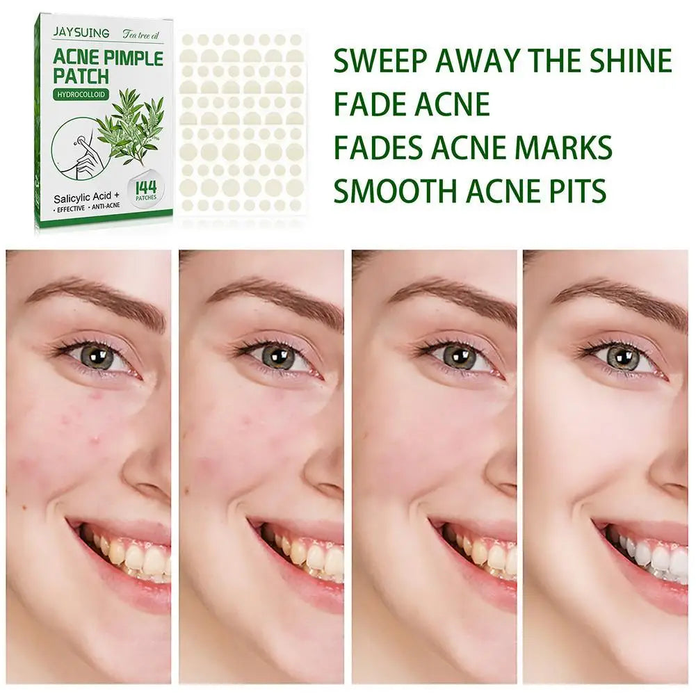 144patch Acne Pimple Patches Translucent Matte Hydrocolloid Salicylic Acid Tea Tree Oil For Inflamed Acne Improve Whiteheads