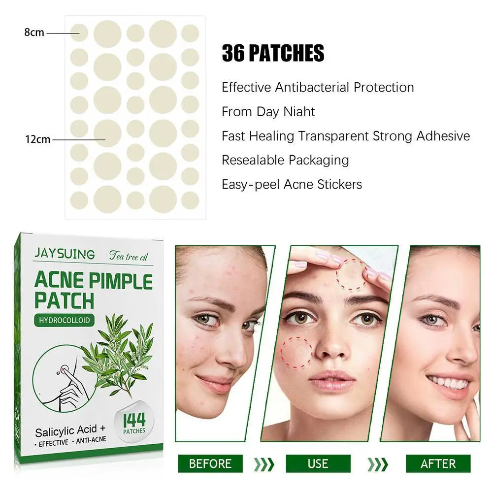 144patch Acne Pimple Patches Translucent Matte Hydrocolloid Salicylic Acid Tea Tree Oil For Inflamed Acne Improve Whiteheads