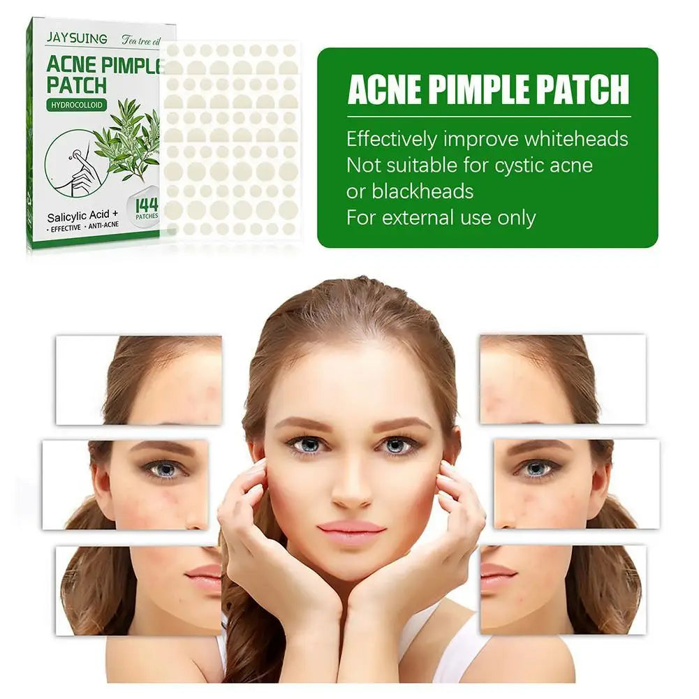 144patch Acne Pimple Patches Translucent Matte Hydrocolloid Salicylic Acid Tea Tree Oil For Inflamed Acne Improve Whiteheads